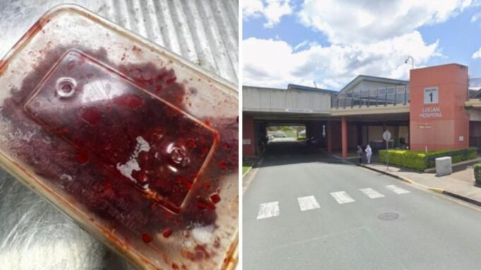 昆士蘭州老鼠中毒病例 昆士蘭州老鼠中毒病例來源被確定為緊急健康警報| mtgamer.com