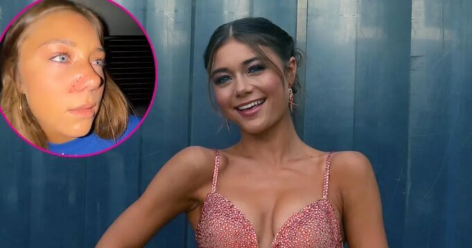 DWTS 的 Hailey Bills 在狂野的感恩節比賽后透露可能鼻子骨折
| mtgamer.com