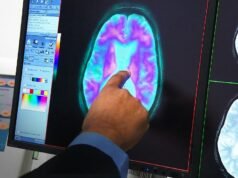 癡呆症現已正式成為澳大利亞的首要死因
| mtgamer.com 癡呆症現已正式成為澳大利亞的首要死因
| mtgamer.com