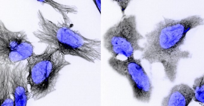 藥物可能成為致命兒童癌症的潛在突破
| mtgamer.com
