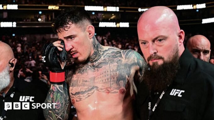 阿斯皮諾爾被診斷患有罕見的眼部疾病
| mtgamer.com