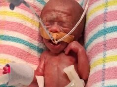 剛出生的小查理打破了昆士蘭最小嬰兒的記錄
| mtgamer.com 剛出生的小查理打破了昆士蘭最小嬰兒的記錄
| mtgamer.com