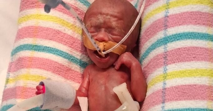 剛出生的小查理打破了 剛出生的小查理打破了昆士蘭最小嬰兒的記錄
| mtgamer.com