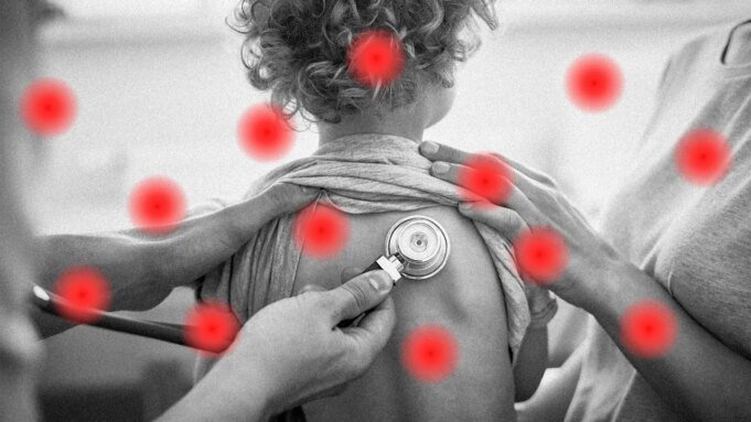 南卡羅來納州爆發麻疹 南卡羅來納州爆發麻疹,全國感染率已達到 1992 年以來的最高水平
| mtgamer.com