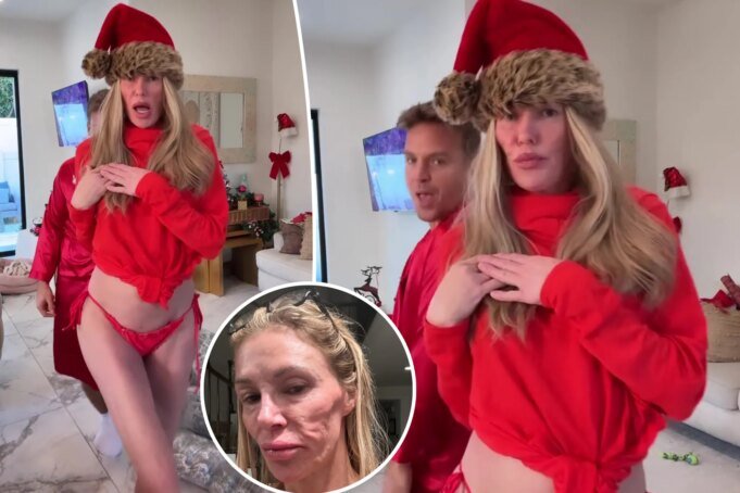 布蘭迪·格蘭維爾 ( 布蘭迪·格蘭維爾 (Brandi Glanville) 被診斷出面部毀容後,在度假視頻中穿上紅色比基尼泳褲
| mtgamer.com