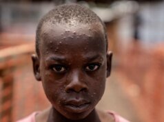 美國退出世界衛生組織對全球健康意味著什麼?
| mtgamer.com 美國退出世界衛生組織對全球健康意味著什麼?
| mtgamer.com