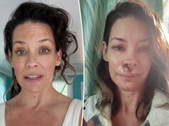 伊万傑琳·莉莉分享腦外傷後的治療計劃:“我花了很多錢”
| mtgamer.com 伊万傑琳·莉莉分享腦外傷後的治療計劃:“我花了很多錢”
| mtgamer.com