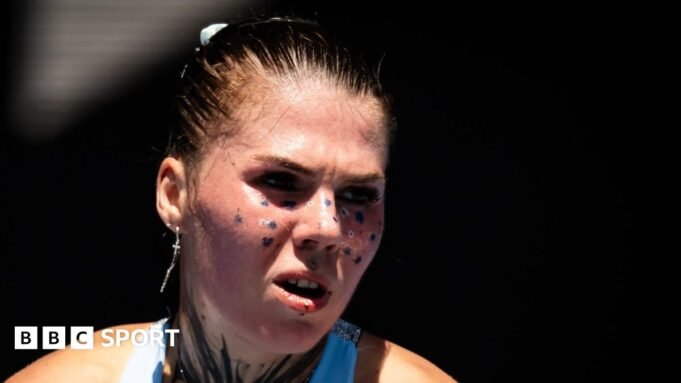 倖存的炸彈和成為職業網球運動員的渴望
 | mtgamer.com