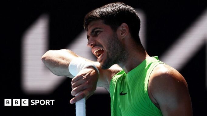 為什麼 Alcaraz、Sinner 和 Sabalenka 必須摘掉健身追踪器？
 | mtgamer.com