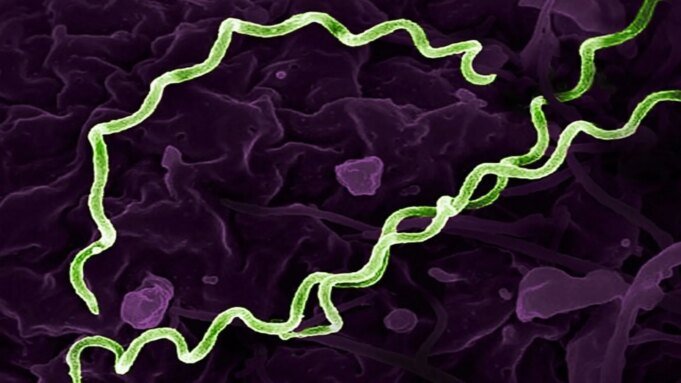 研究發現5550歲哥倫比亞男子攜帶世界上最古老的梅毒相關細菌
 | mtgamer.com